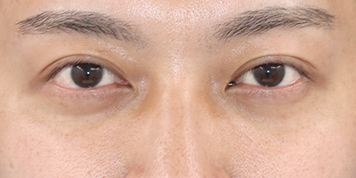 After image