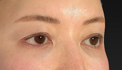 Before image