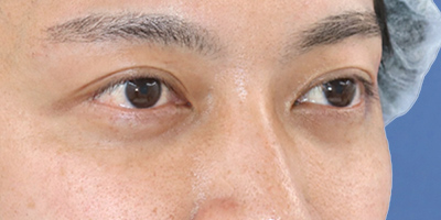 After image