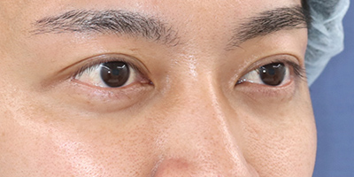After image