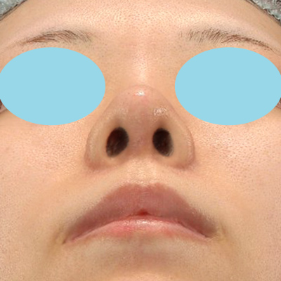 After image