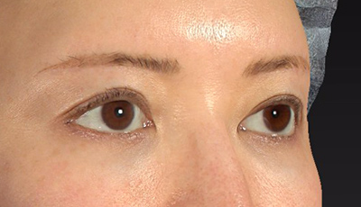 After image