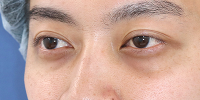 Before image