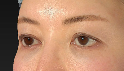 Before image