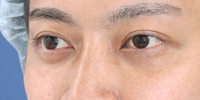 After image