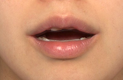After image