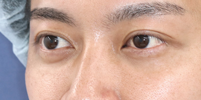 After image