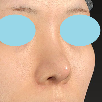 After image