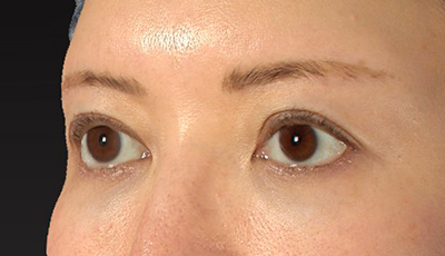After image