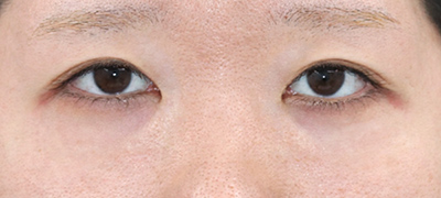 Before image