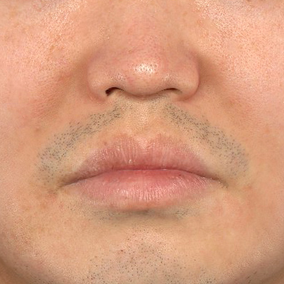 Before image