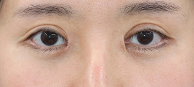 After image