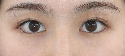 After image