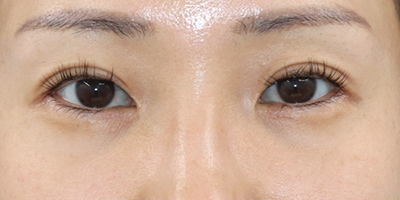 After image