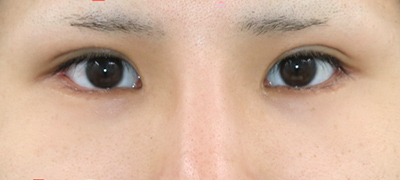 After image