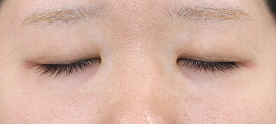 Before image