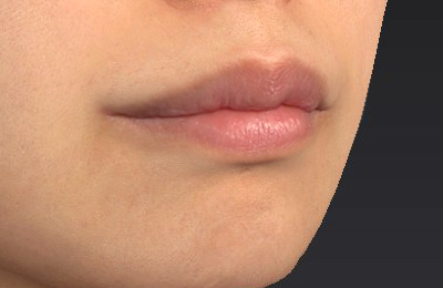 After image