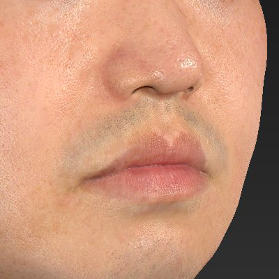 After image
