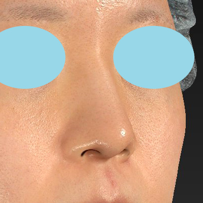 Before image