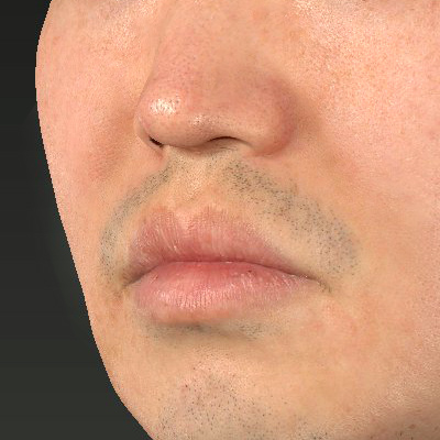 Before image