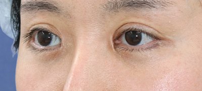 After image
