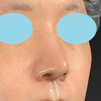 After image