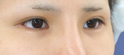 After image