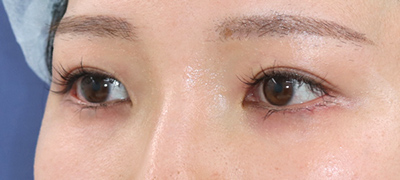 After image