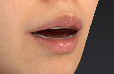 After image