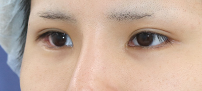 After image