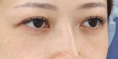 After image