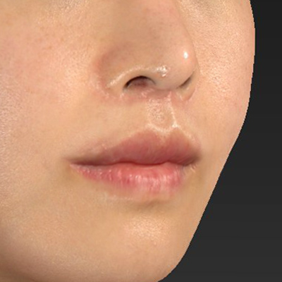 After image