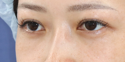 After image
