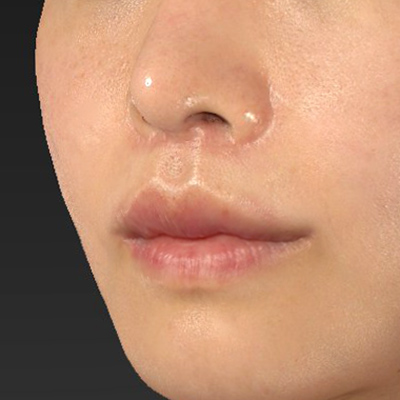 After image
