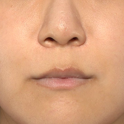 Before image
