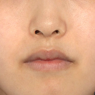 Before image