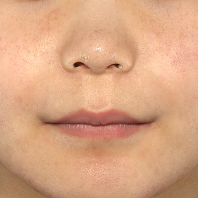 Before image