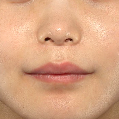 After image