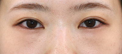 After image