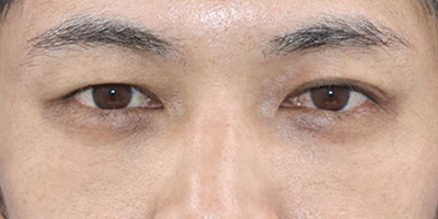 After image