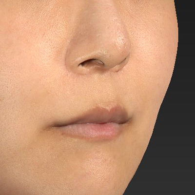 Before image