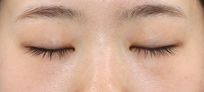 Before image