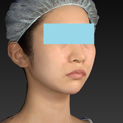 Before image