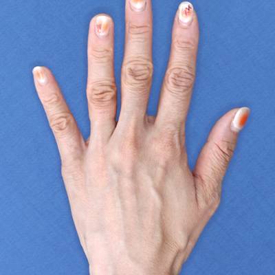 Before image