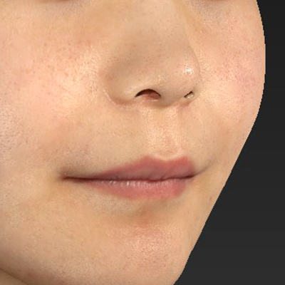 Before image