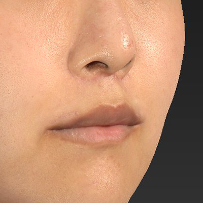 After image