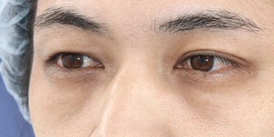 Before image