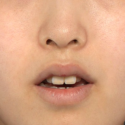 Before image