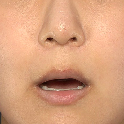 Before image