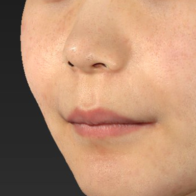 Before image